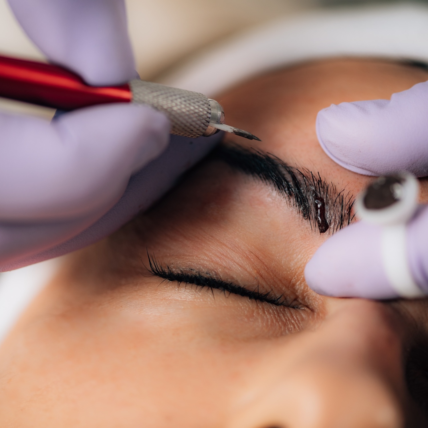 Clinica Blau de Mar Arenys de Mar – eyebrow-treatment-procedure-in-beauty-clinic-2026-01-05-06-32-47-utc
